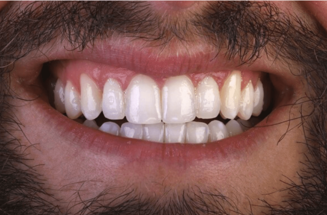 After - fleurdental