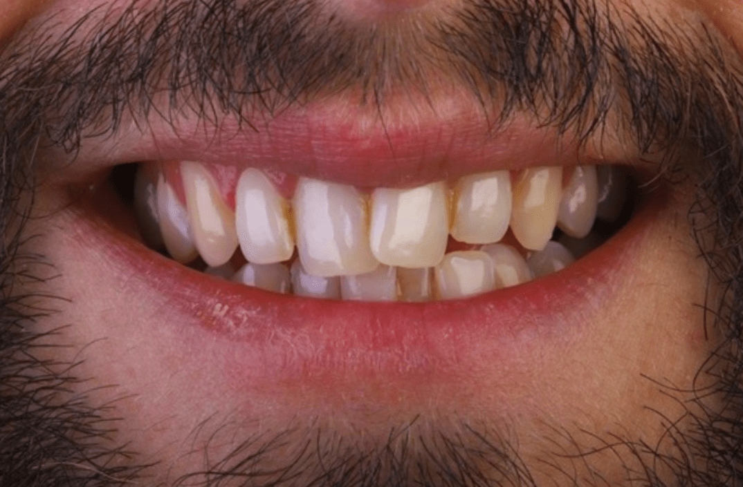 Before - fleurdental