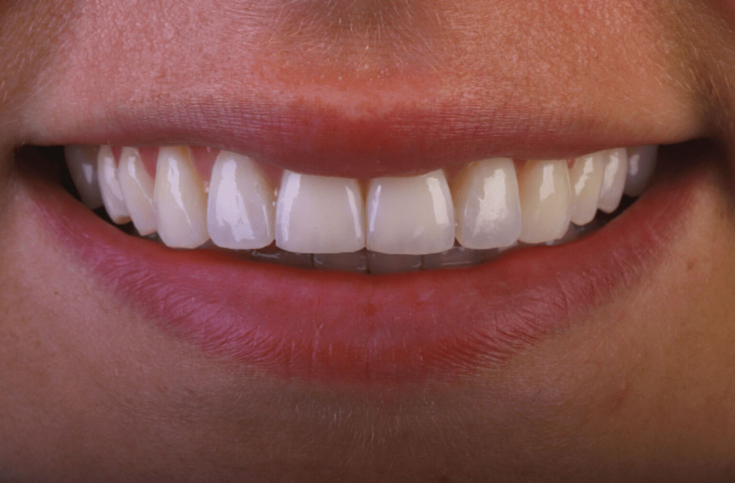 After - fleurdental