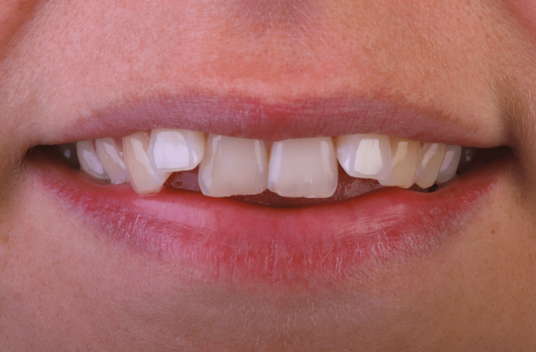 Before - fleur dental