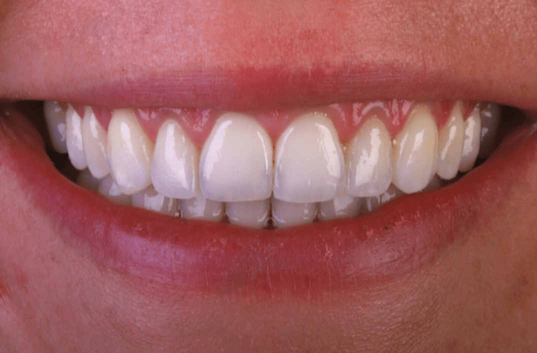 After - fleurdental