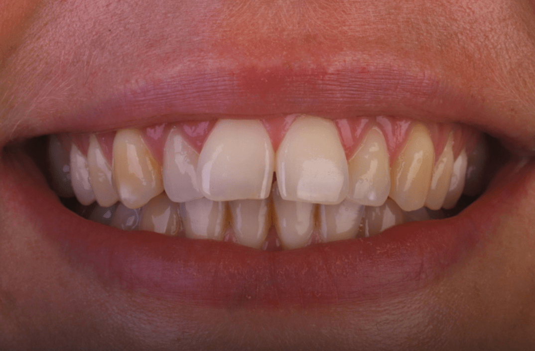 Before - fleur dental