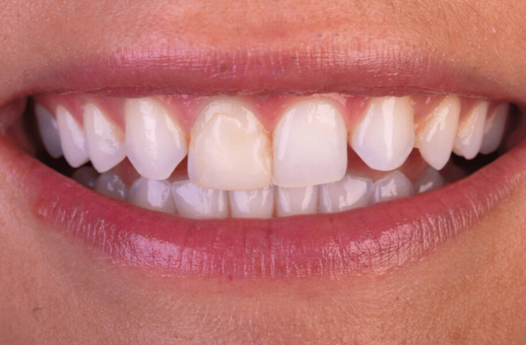 smile-gallery-fleur-dental-dentist-in-garforth-leeds